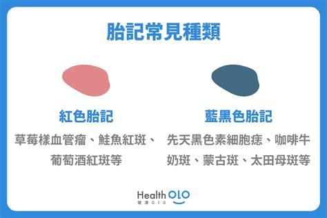 腳底有紅色胎記|胎記怎麼產生、何時消除？醫師剖析胎記種類、胎記寓。